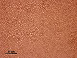 5 - Cellule corticali in visione superficiale